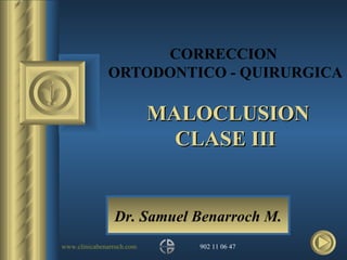 CORRECCION  ORTODONTICO - QUIRURGICA  MALOCLUSION CLASE III Dr. Samuel Benarroch M. 