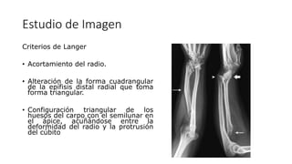 Triangular Protrusion Deformidad de Madelung.pptx