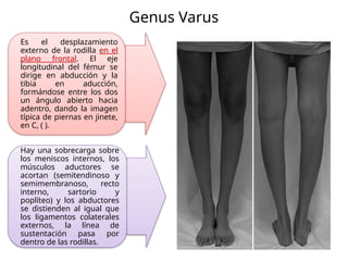 Deformidades_Angulares_de_las_Rodillas..pptx