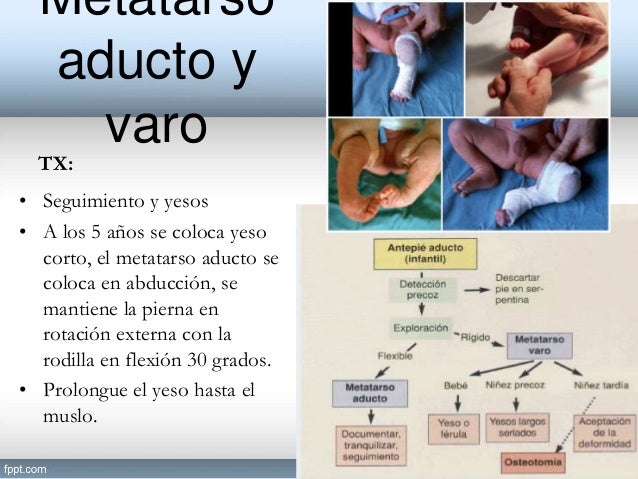 Deformidades congenitas del pie Deformidades congenitas del pie