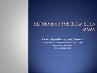 César Augusto Cuadros Serrano
Cirugía Plástica, Estética, Maxilofacial y de la Mano
              Residente de Tercer Año
               Universidad del Valle
 