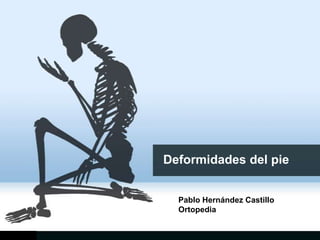 Deformidades del pie


  Pablo Hernández Castillo
  Ortopedia
 