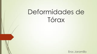Deformidades de
Tórax
Eros Jaramillo
 