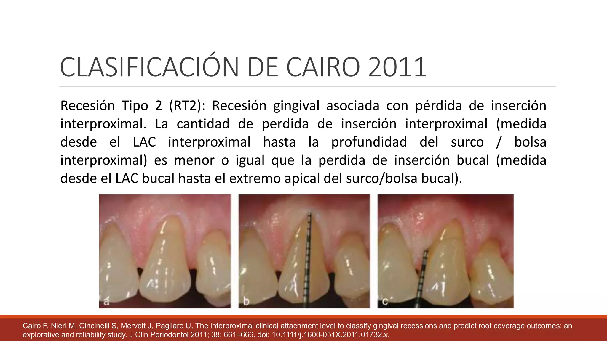 Deformidades y Condiciones mucogingivales en diente y reborde NUEVA.pptx