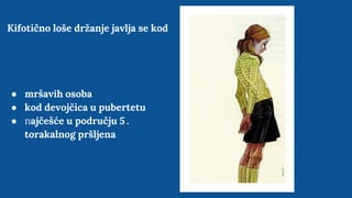 Kifotično loše držanje javlja se kod
● mršavih osoba
● kod devojčica u pubertetu
● najčešće u području 5 .
torakalnog pršljena
 