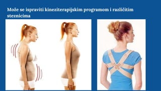Može se ispraviti kineziterapijskim programom i različitim
steznicima
 