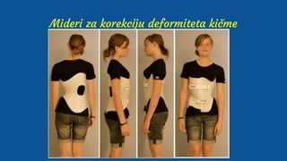 Mideri za korekciju deformiteta kičme
 