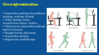 Uzroci deformiteta kičme:
• Nepravilan položaj tela prilikom
hodanja, sedenja, ležanja
• Teške školske torbe,
neadekvatne klupe i stolice
• Višečasovno nepravilno sedenje
ispred računara
• Manjak fizičke aktivnosti
• Nepravilna ishrana
• Mogućnost nasleđivanja
 