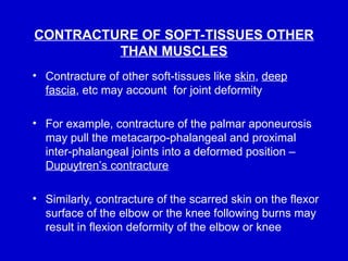 Contractures Examples Comprehensive Overview of Causes and Management of Deformities in ...