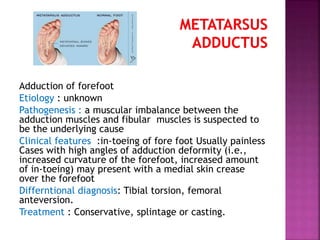 Adduction of forefoot
Etiology : unknown
Pathogenesis : a muscular imbalance between the
adduction muscles and fibular muscles is suspected to
be the underlying cause
Clinical features :in-toeing of fore foot Usually painless
Cases with high angles of adduction deformity (i.e.,
increased curvature of the forefoot, increased amount
of in-toeing) may present with a medial skin crease
over the forefoot
Differntional diagnosis: Tibial torsion, femoral
anteversion.
Treatment : Conservative, splintage or casting.
 