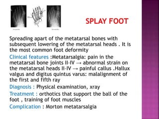 Spreading apart of the metatarsal bones with
subsequent lowering of the metatarsal heads . It is
the most common foot deformity
Clinical features :Metatarsalgia: pain in the
metatarsal bone joints II–IV → abnormal strain on
the metatarsal heads II–IV → painful callus .Hallux
valgus and digitus quintus varus: malalignment of
the first and fifth ray
Diagnosis : Physical examination, xray
Treatment : orthotics that support the ball of the
foot , training of foot muscles
Complication : Morton metatarsalgia
 