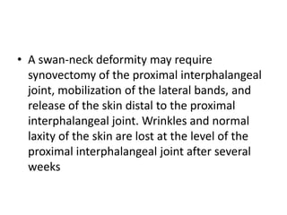 • Nalebuff, Feldon, and Millender categorized
swan-neck deformities into four types and
recommended appropriate treatment ...
