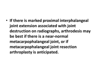 • Numerous fixation techniques have been
described to obtain successful proximal
interphalangeal joint arthrodesis in arth...
