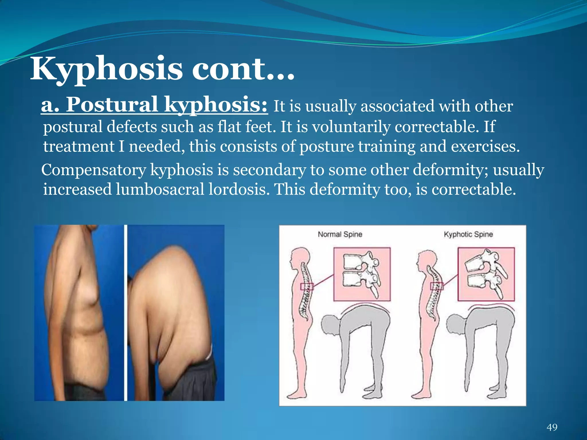Deformities Of Human Body | PPTX