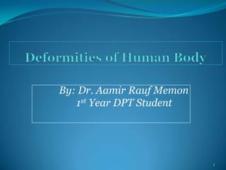 Deformities of Human Body By: Dr. Aamir RaufMemon            1st Year DPT Student  1 