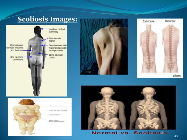 Deformities Of Human Body | PPTX
