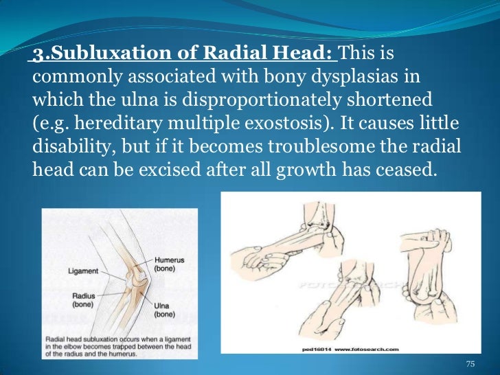 Deformities Of Human Body