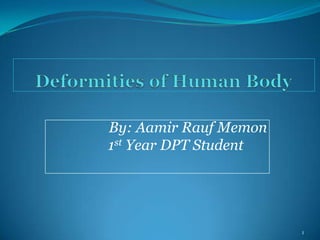 By: Aamir Rauf Memon
1st Year DPT Student




                       1
 