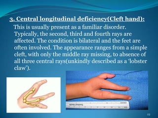 Deformities of human body pps | PPSX