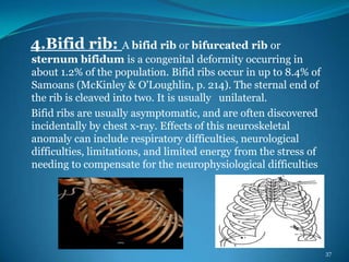 Bifid First Rib Deformities of human body pps | PPSX