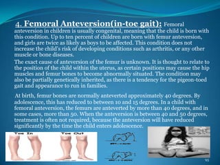 Deformities of human body pps | PPSX
