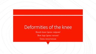 Deformities of the knee
Knock knee (genu valgum)
Bow legs (genu varum)
Genu recurvatum
 
