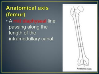 • A mid diaphyseal line
passing along the
length of the
intramedullary canal.
 