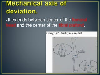 - It extends between center of the femoral
head and the center of the tibial plafond.
 