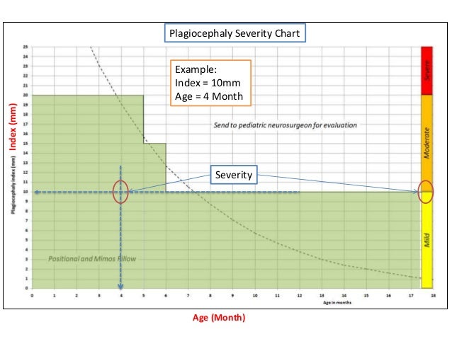 Plagiocephaly Measurement with Craniometer: Diagnosis, Prevention,