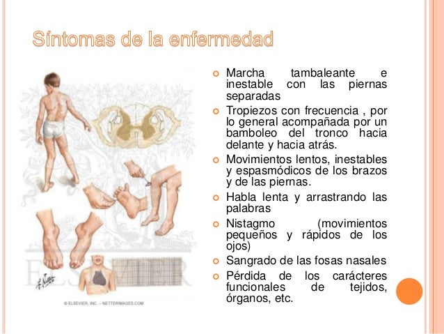 Degeneración espinocerebelosa