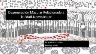 Degeneración Macular Relacionada a
la Edad-Neovascular
Dr. Eder Díaz Dorado
Retina y Vítreo
 