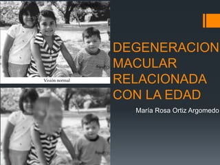 DEGENERACION
MACULAR
RELACIONADA
CON LA EDAD
  María Rosa Ortiz Argomedo
 