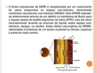 A forma neovascular da DMRI é caracterizada por um crescimento de vasos sanguíneos no espaço sub-retiniano, denominada membrana neovascular sub-retiniana (MNSR). Esta MNSR estende-se anteriormente através de um defeito na membrana de Bruchpara o espaço abaixo do epitélio pigmentar da retina (EPR), e/ou da retina neurosensorial, levando ao acúmulo de líquido nesse espaço sub-retiniano, sangue, ou lipídios. Estes efeitos secundários da MNSR, adicionados à presença de um tecido cicatricial ou fibroso, ocasiona a perda da visão central.