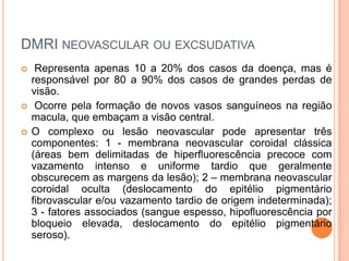 DMRI neovascular ou excsudativaRepresenta apenas 10 a 20% dos casos da doença, mas é responsável por 80 a 90% dos casos de grandes perdas de visão. Ocorre pela formação de novos vasos sanguíneos na região macula, que embaçam a visão central.O complexo ou lesão neovascular pode apresentar três componentes: 1 - membrana neovascular coroidal clássica (áreas bem delimitadas de hiperfluorescência precoce com vazamento intenso e uniforme tardio que geralmente obscurecem as margens da lesão); 2 – membrana neovascular coroidal oculta (deslocamento do epitélio pigmentário fibrovascular e/ou vazamento tardio de origem indeterminada); 3 - fatores associados (sangue espesso, hipofluorescência por bloqueio elevada, deslocamento do epitélio pigmentário seroso).