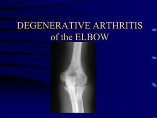DEGENERATIVE ARTHRITIS of the ELBOW 