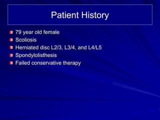 Case Review #18: 79 year old female with Degenerative scoliosis | PDF
