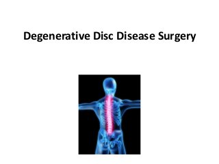 Degenerative Disc Disease Surgery
 