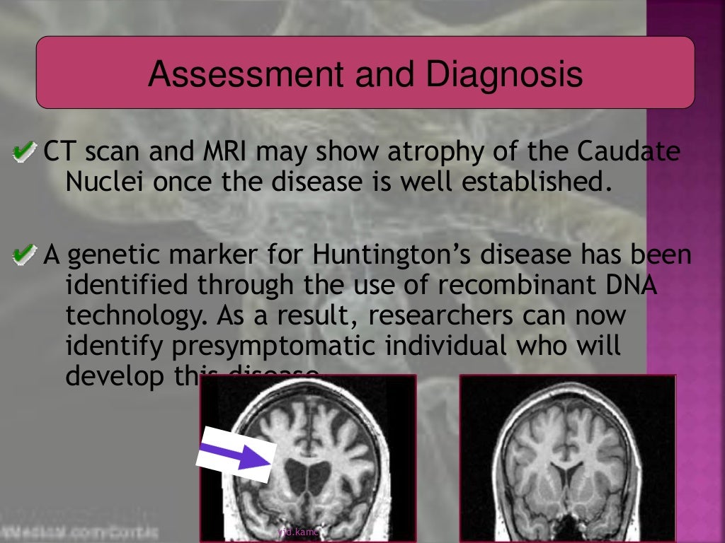Degenerative diseases
