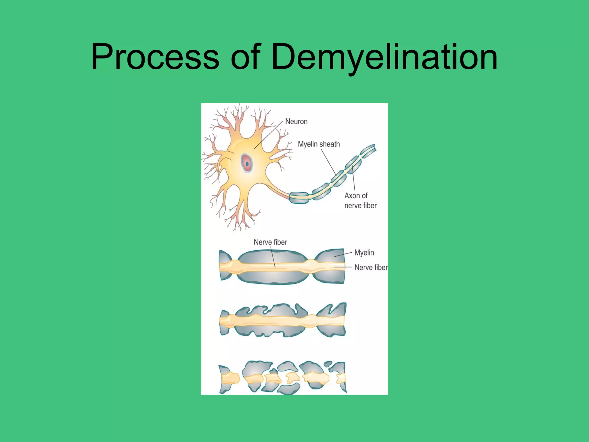 Degenerative disorders