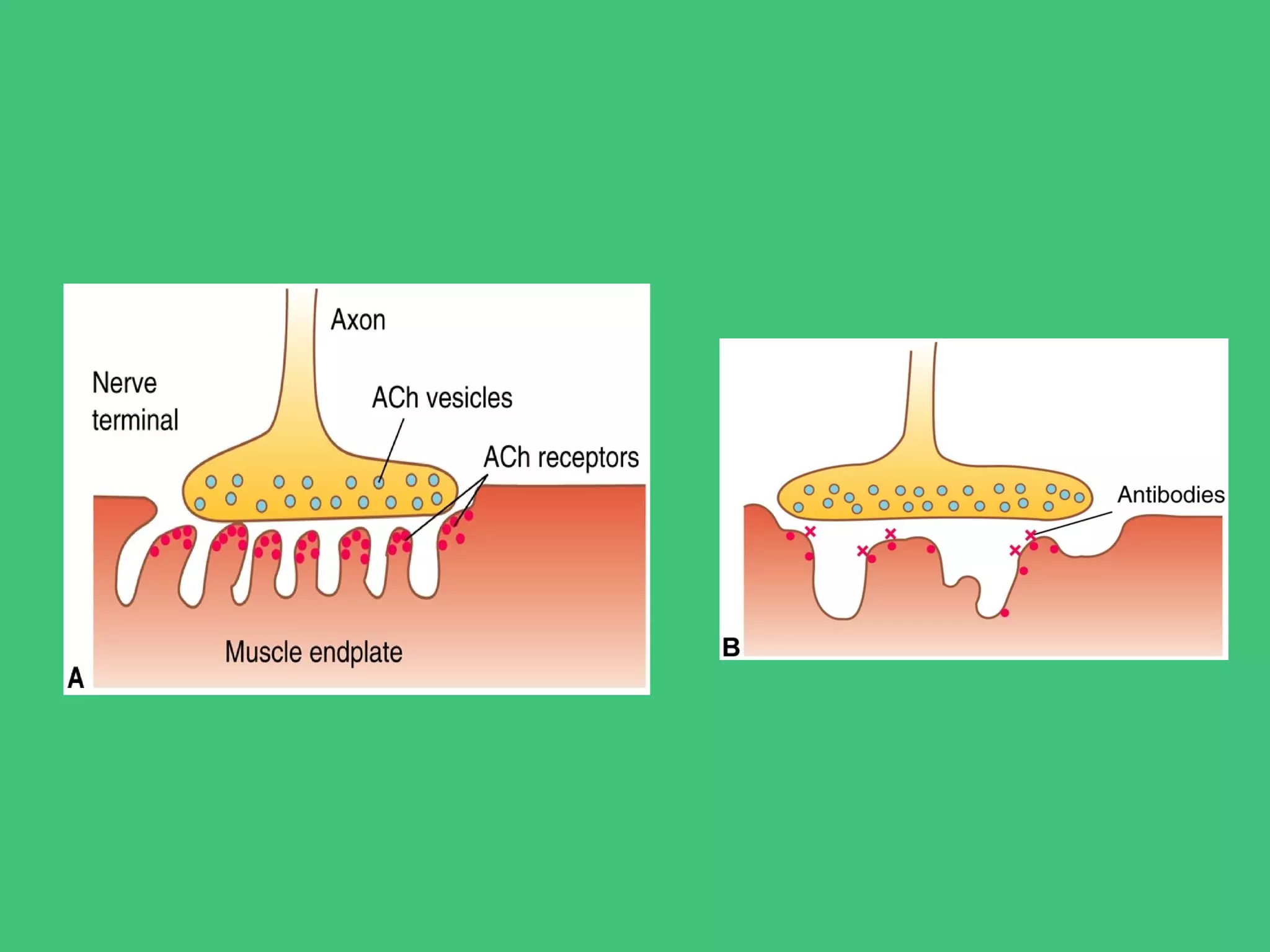 Degenerative disorders