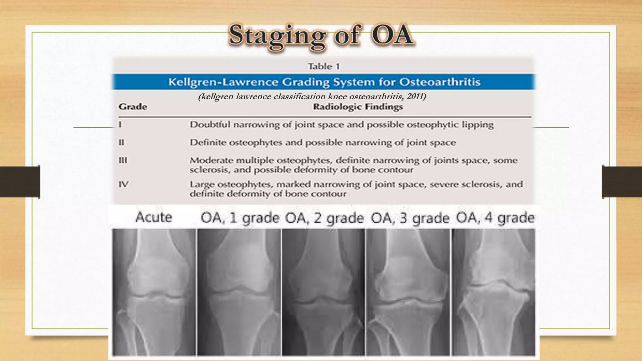 DEGENERATIVE JOINT DISEASE.pptx