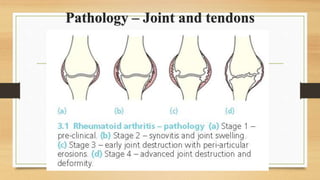 Pathology – Joint and tendons
 