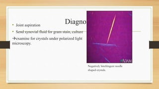 Diagnosis
• Joint aspiration
• Send synovial fluid for gram stain, culture
examine for crystals under polarized light
microscopy.
Negatively birefringent needle
shaped crystals.
 