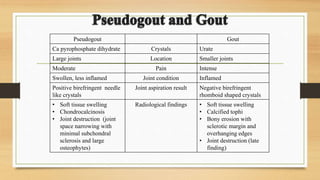 Pseudogout Gout
Ca pyrophosphate dihydrate Crystals Urate
Large joints Location Smaller joints
Moderate Pain Intense
Swollen, less inflamed Joint condition Inflamed
Positive birefringent needle
like crystals
Joint aspiration result Negative birefringent
rhomboid shaped crystals
• Soft tissue swelling
• Chondrocalcinosis
• Joint destruction (joint
space narrowing with
minimal subchondral
sclerosis and large
osteophytes)
Radiological findings • Soft tissue swelling
• Calcified tophi
• Bony erosion with
sclerotic margin and
overhanging edges
• Joint destruction (late
finding)
 