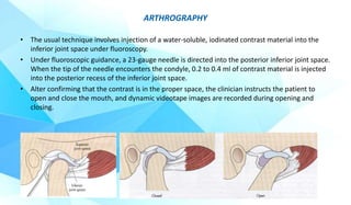 Degenerative joint disorders of temporomandibular joint | PPTX