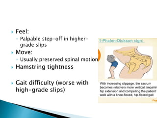 Degenerative Spondylolisthesis | PPTX