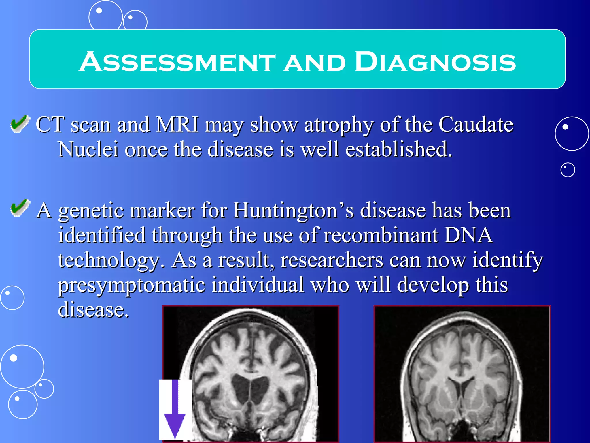 CT scan and MRI may show atrophy of the Caudate Nuclei once the disease is well established. A genetic marker for Huntington’s disease has been identified through the use of recombinant DNA technology. As a result, researchers can now identify presymptomatic individual who will develop this disease.  Assessment and Diagnosis 
