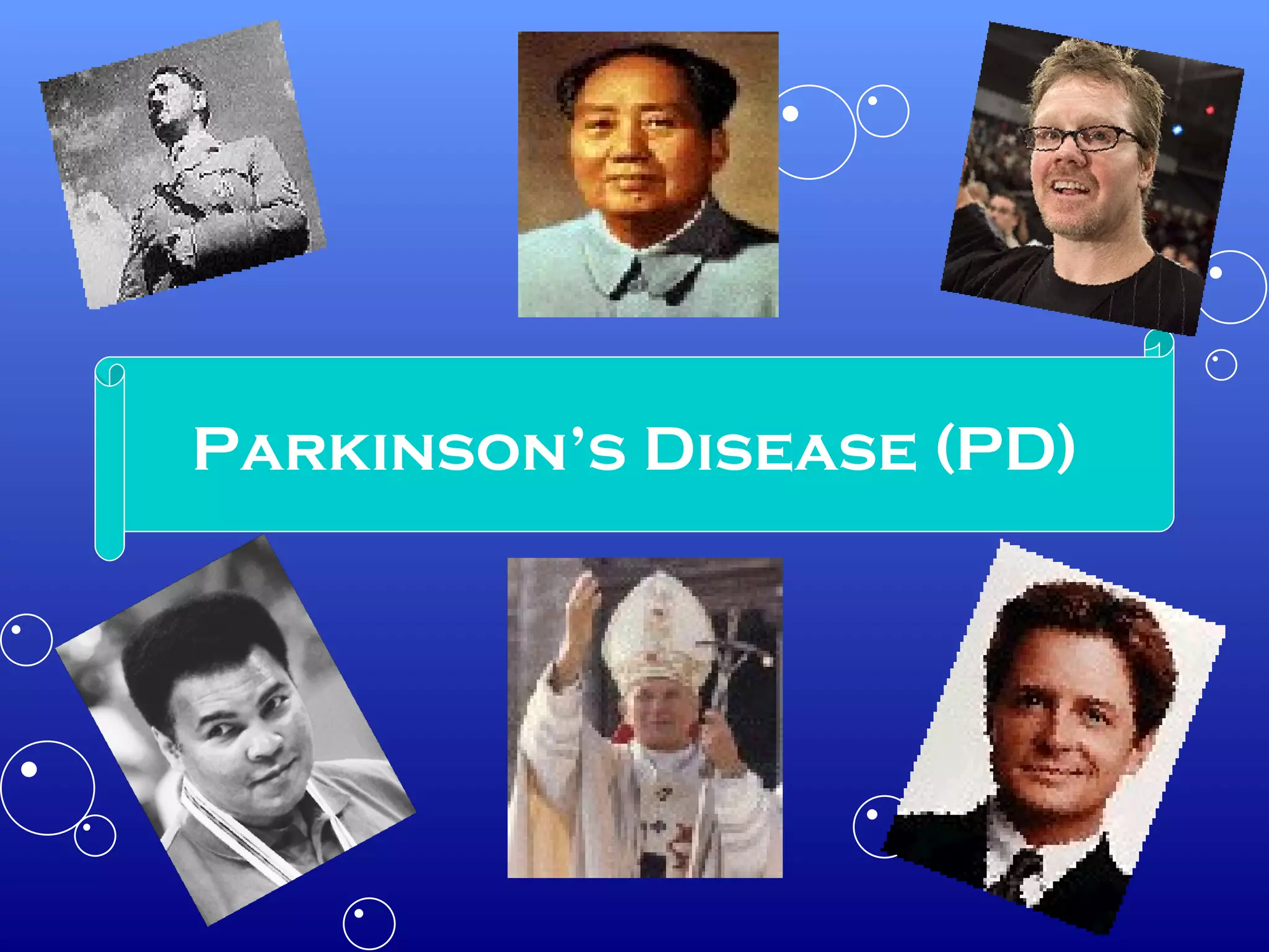 Parkinson’s Disease (PD) 