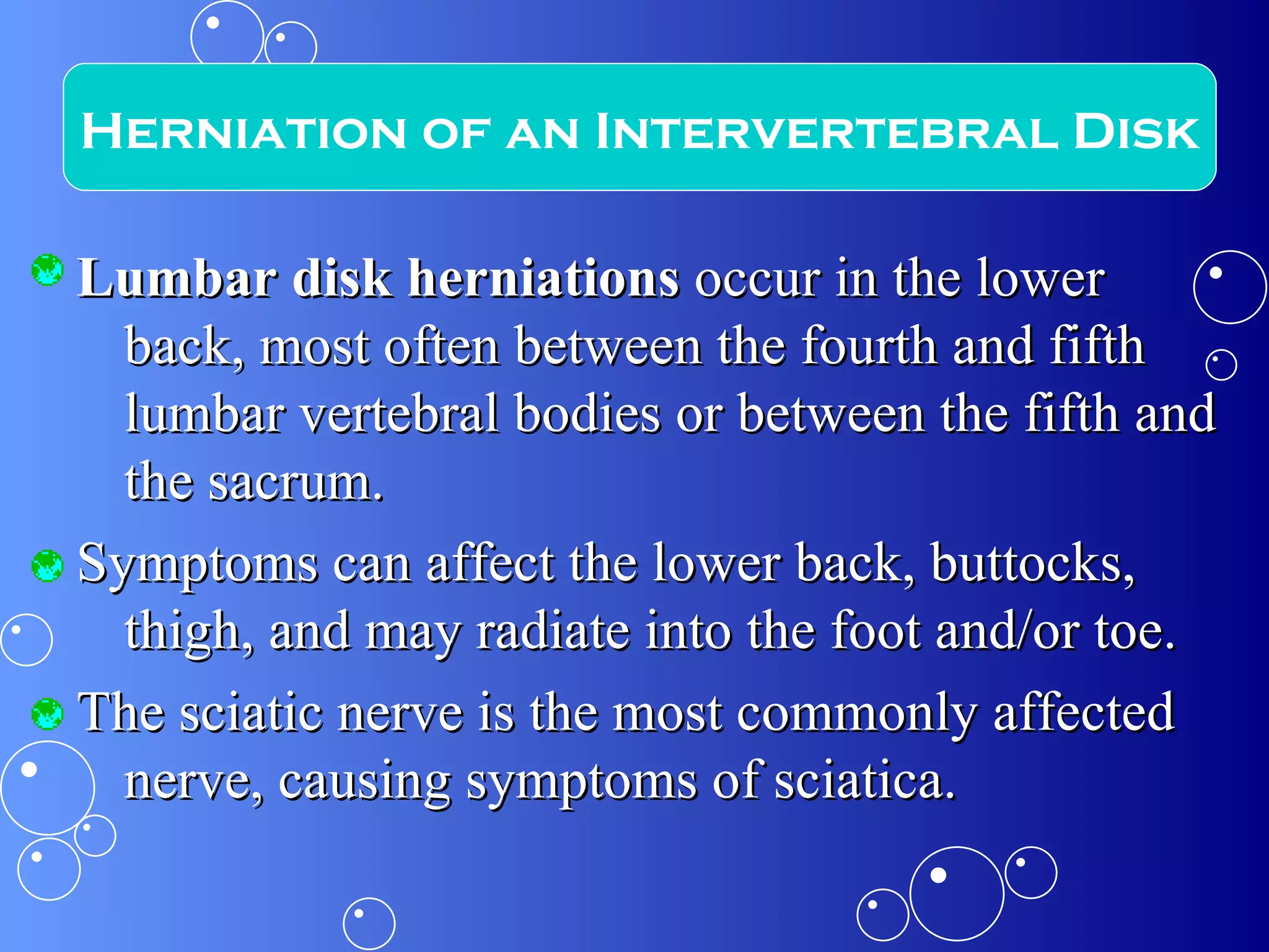 Lumbar disk herniations  occur in the lower back, most often between the fourth and fifth lumbar vertebral bodies or between the fifth and the sacrum.  Symptoms can affect the lower back, buttocks, thigh, and may radiate into the foot and/or toe.  The sciatic nerve is the most commonly affected nerve, causing symptoms of sciatica. Herniation of an Intervertebral Disk 