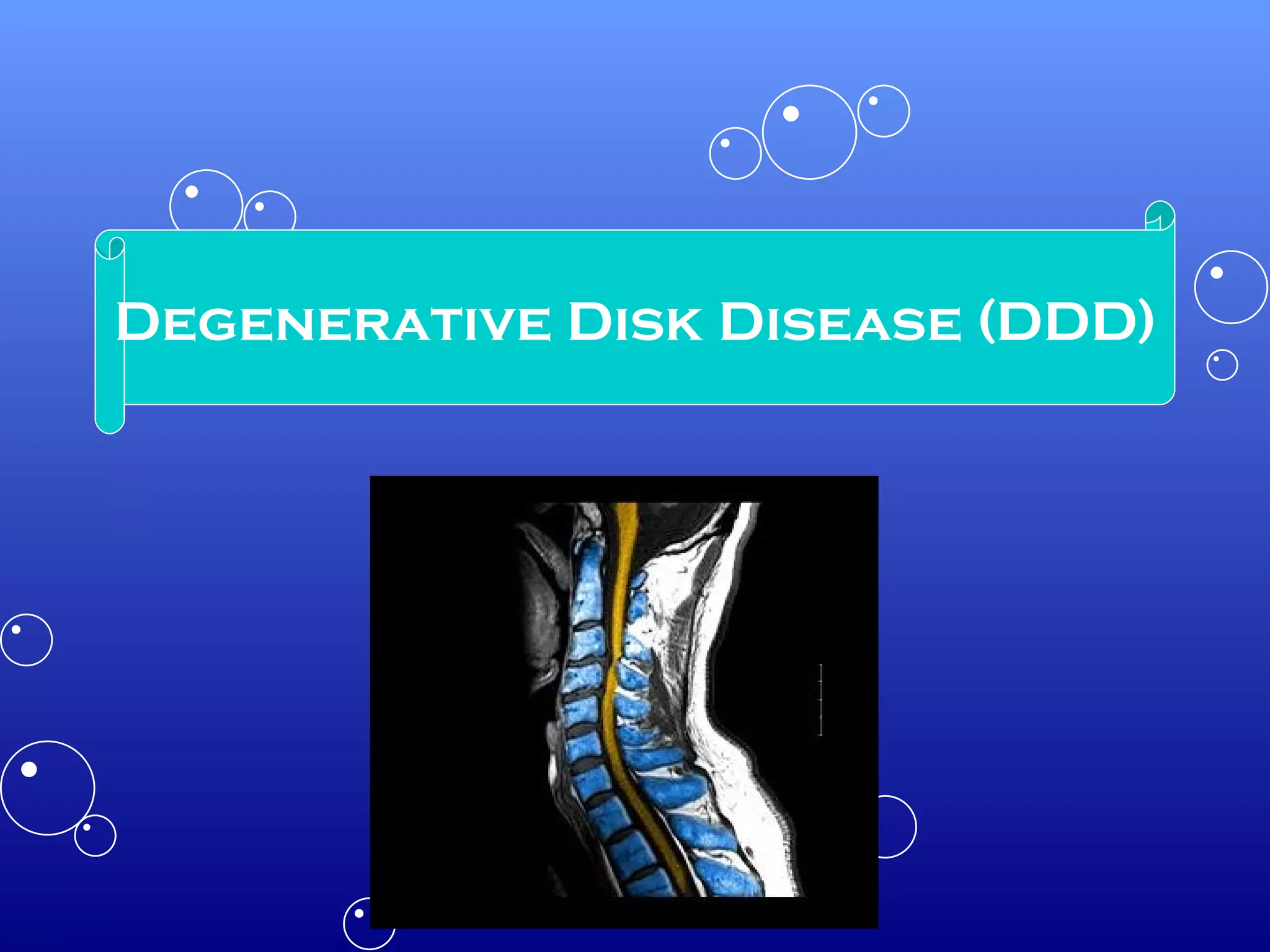 Degenerative Disk Disease (DDD) 